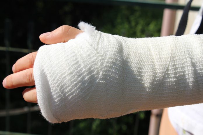 fractura