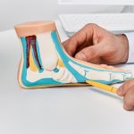 Anatomical,Flat,Foot,Model,On,Doctor,Table,While,Consultation,In