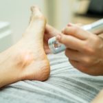 An,Unrecognizable,Podiatrist,Performs,Laser,Therapy,On,An,Athlete’s,Foot.